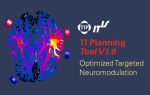 Read more about the article TI Planning Tool V1.0 –深腦刺激的規劃工具